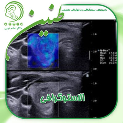 الاستوگرافی - دکتر غیبی