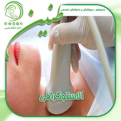 الاستوگرافی - دکتر غیبی