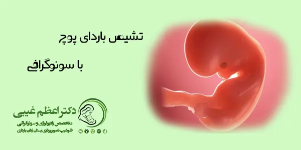بارداری پوچ