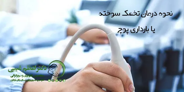 درمان بارداری پوچ