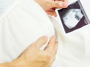 اهمیت انجام سونوگرافی بارداری