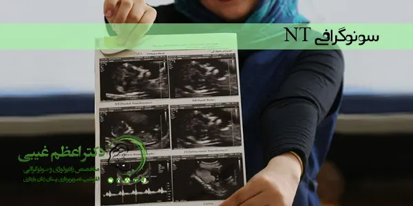 سونوگرافی NT چیست؟