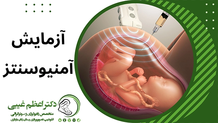 آزمایش آمنیوسنتز