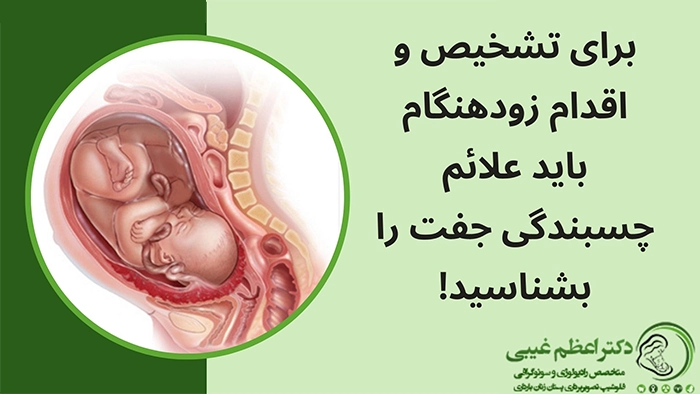 علائم چسبندگی جفت