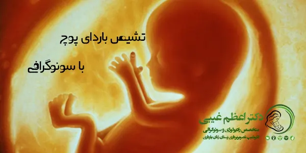 تشخیص با شرح حال بالینی بیمار (مانند خونریزی) و انجام سونوگرافی انجام میشود. روش های سونوگرافی عبارتند از سونوگرافی شکمی و سونوگرافی واژینال می شود.