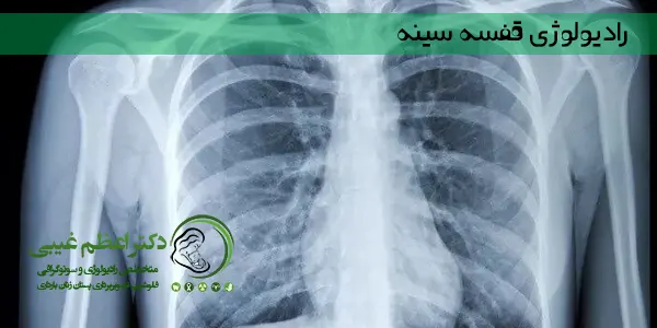 اشعه ایکس قفسه سینه آزمایشی است که تصویری از قلب، ریه ها و استخوان های شما ایجاد می کند. نام دیگر آن رادیولوژی قفسه سینه می باشد.