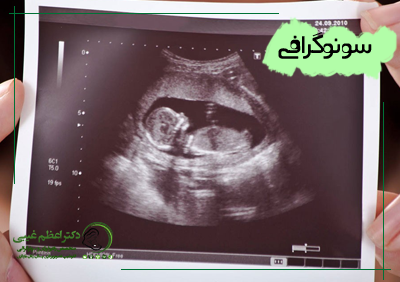 تعیین جنسیت با سونوگرافی