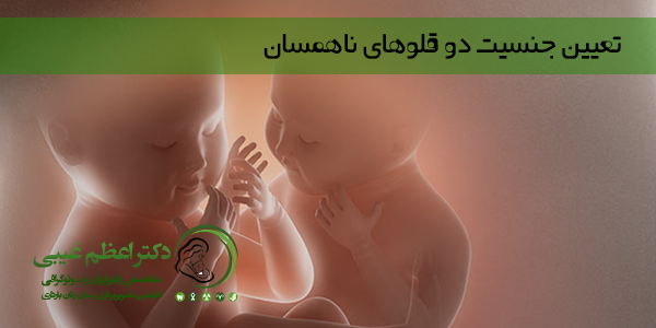 تعیین جنسیت دو قلوهای ناهمسان