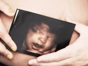 سونوگرافی 3 بعدی و 4 بعدی چیست؟