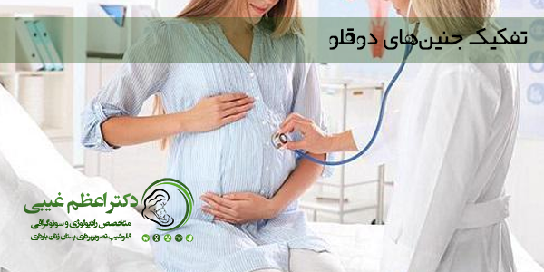 تفکیک جنینهای دوقلو