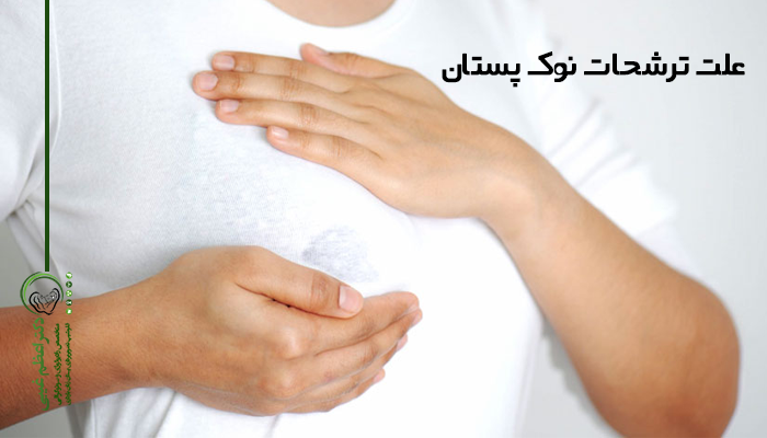 علت ترشحات نوک پستان
