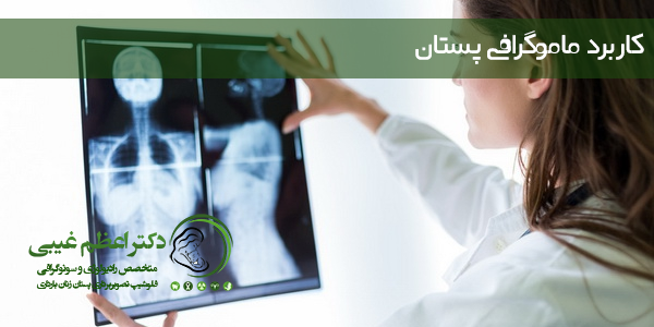 کاربرد ماموگرافی پستان