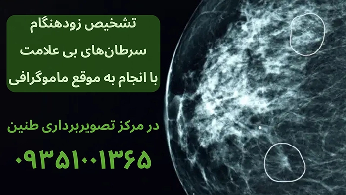 تشخیص زودهنگام سرطان با ماموگرافی