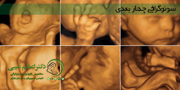 سونوگرافی چهار بعدی