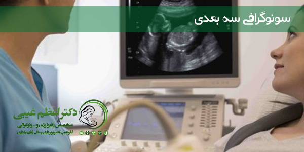 مهم ترین نکات در مورد سونوگرافی سه بعدی