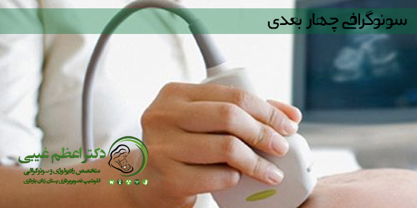 سونوگرافی چهار بعدی