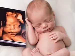 سونوگرافی چهار بعدی چیست ؟