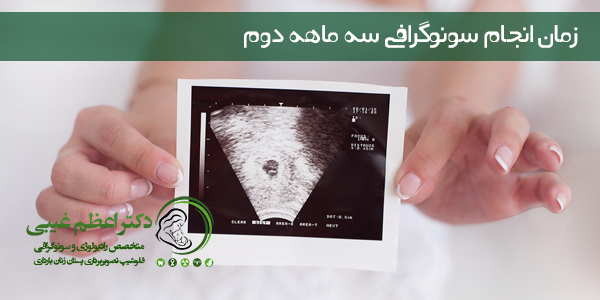 مناسب ترین زمان انجام سونوگرافی سه ماهه دوم بارداری