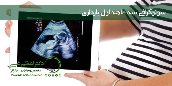 سونوگرافی سه ماهه اول بارداری