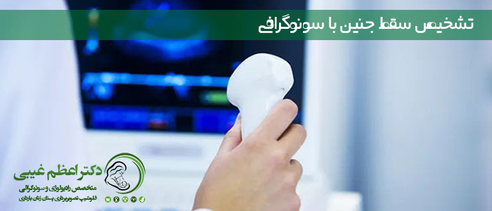 تشخیص سقط جنین با سونوگرافی