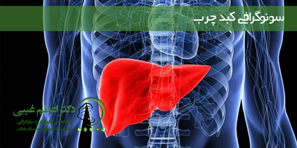 سونوگرافی کبد چرب