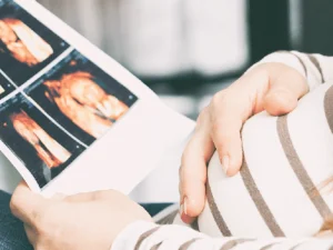 هزینه سونوگرافی