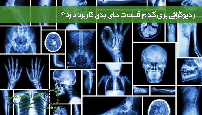 رادیوگرافی برای کدام قسمت های بدن کاربرد دارد؟
