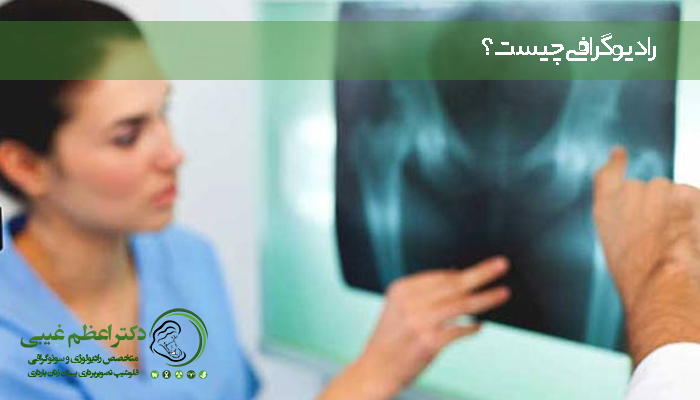 رادیوگرافی چیست؟