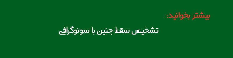تشخیص سقط جنین با سونوگرافی