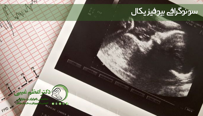 سونوگرافی بیوفیزیکال