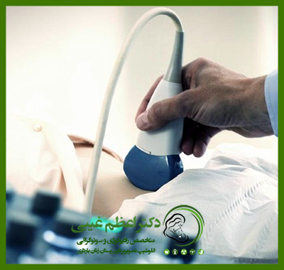 اقدامات مهم قبل از سونوگرافی شکم