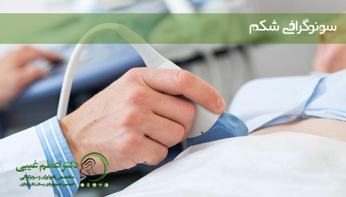 سونوگرافی شکم