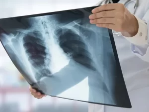 رادیوگرافی دیجیتال چیست ؟