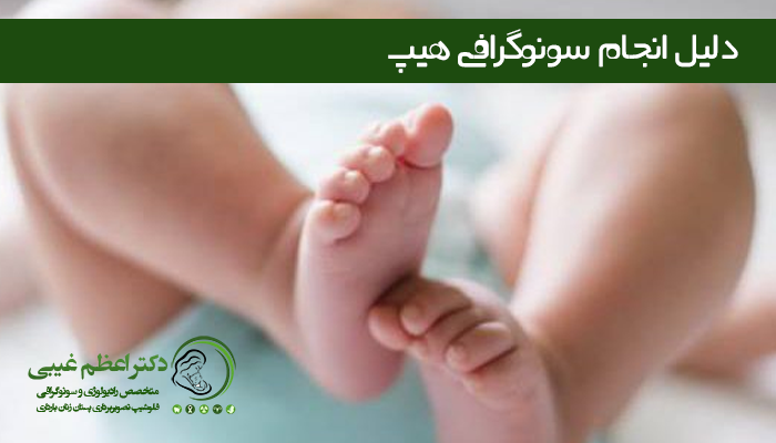 دلایل انجام سونوگرافی هیپ
