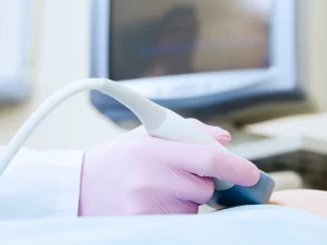 مناسب ترین زمان انجام سونوگرافی سینه