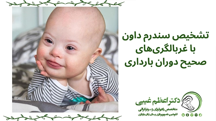 سونوگرافی سندرم داون