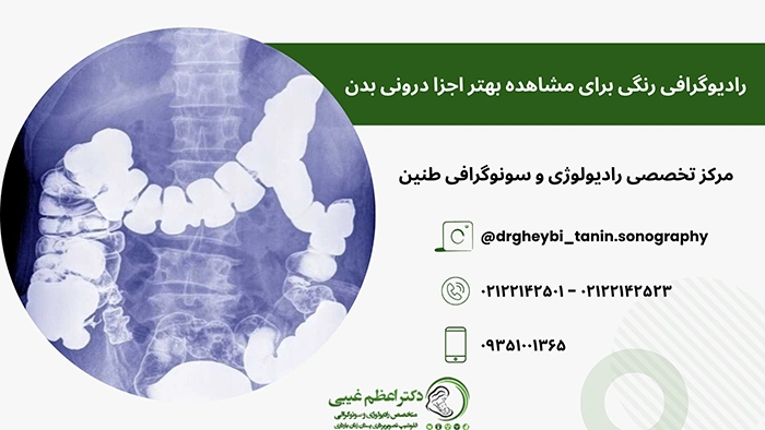 رادیوگرافی رنگی