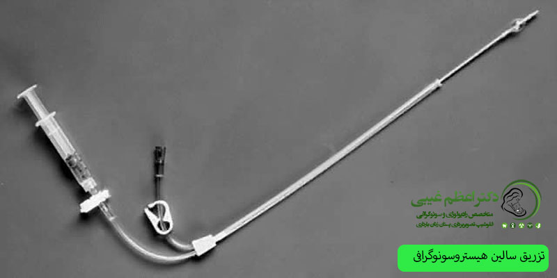 تزریق-سالین در هیسترسونوگرافی