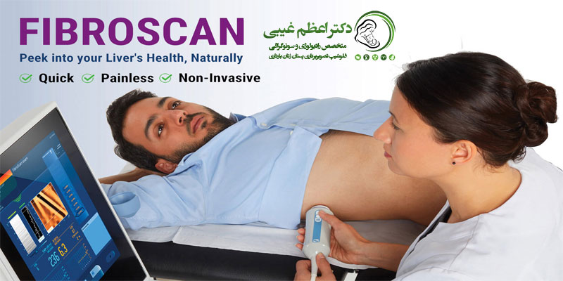 فیبرواسکن-چیست؟