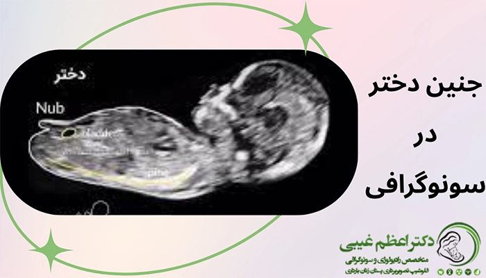 جنین دختر در سونوگرافی