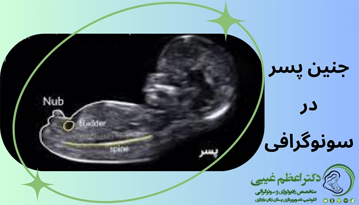 جنین پسر در سونوگرافی