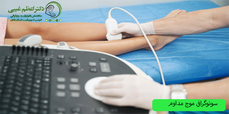 سونوگرافی-موج-مداوم