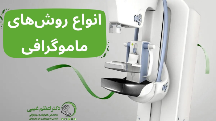 روش های ماموگرافی