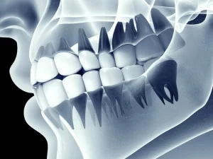 رادیولوژی فک و صورت