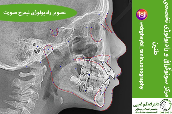 رادیولوژی نیمرخ صورت