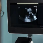 هزینه سونوگرافی آنومالی